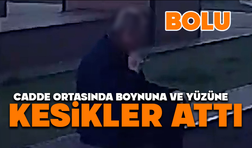 Cadde ortasında boynuna ve yüzüne kesikler attı